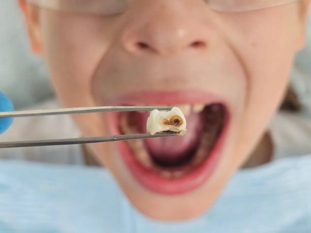 Best Emergency Dental Care for Trauma or Injury in Brooklyn Park, MD